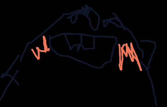 Crag